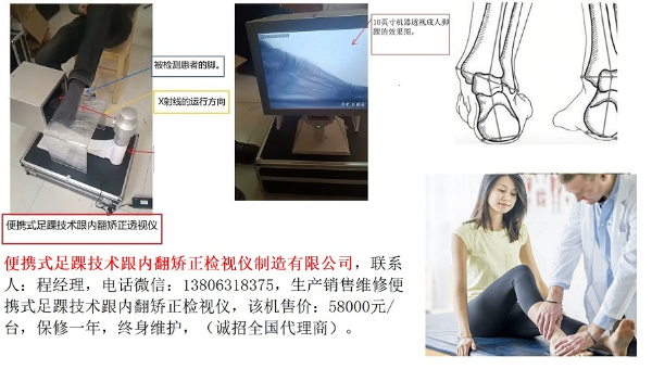 便携式足踝技术跟内翻矫正检视仪